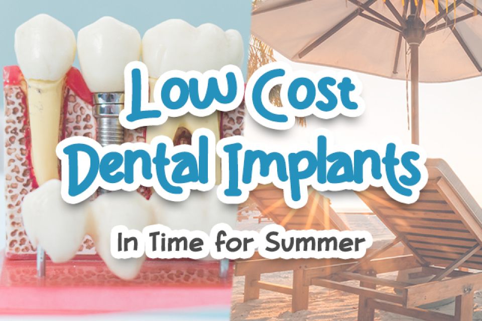 Low Cost Dental Implants in Time for Summer