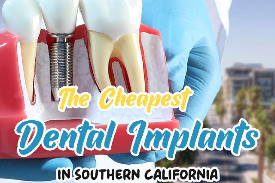 Cheapest Dental Implants Near Me in SoCal