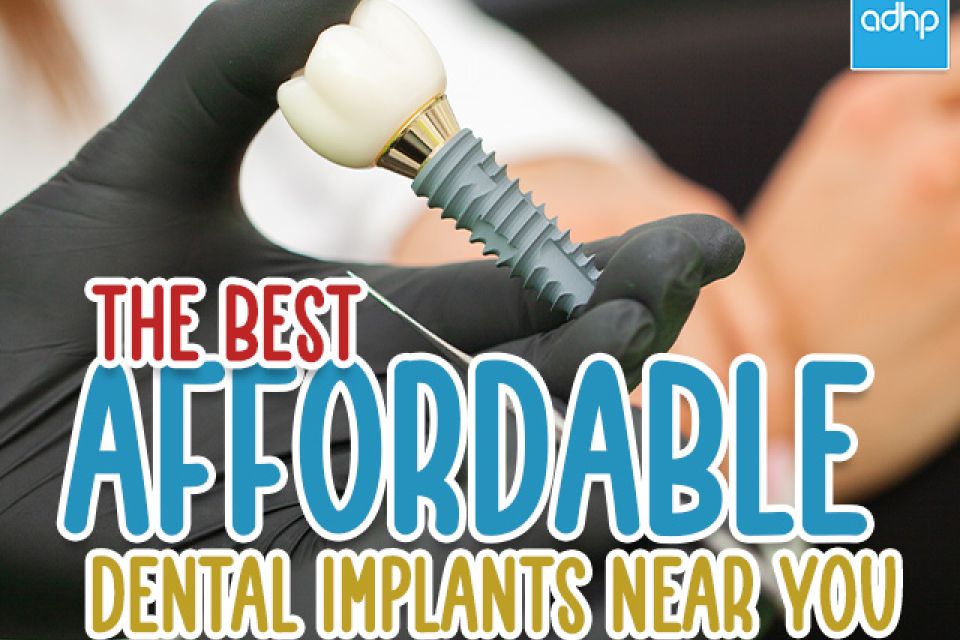 The Best Affordable Dental Implants Near Me