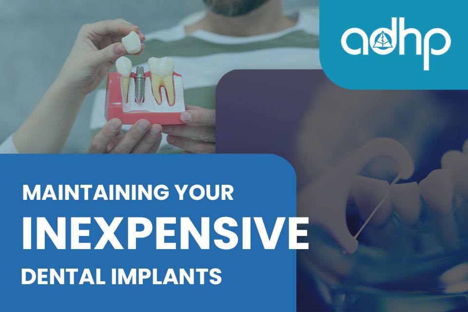 Maintaining Your Inexpensive Dental Implants